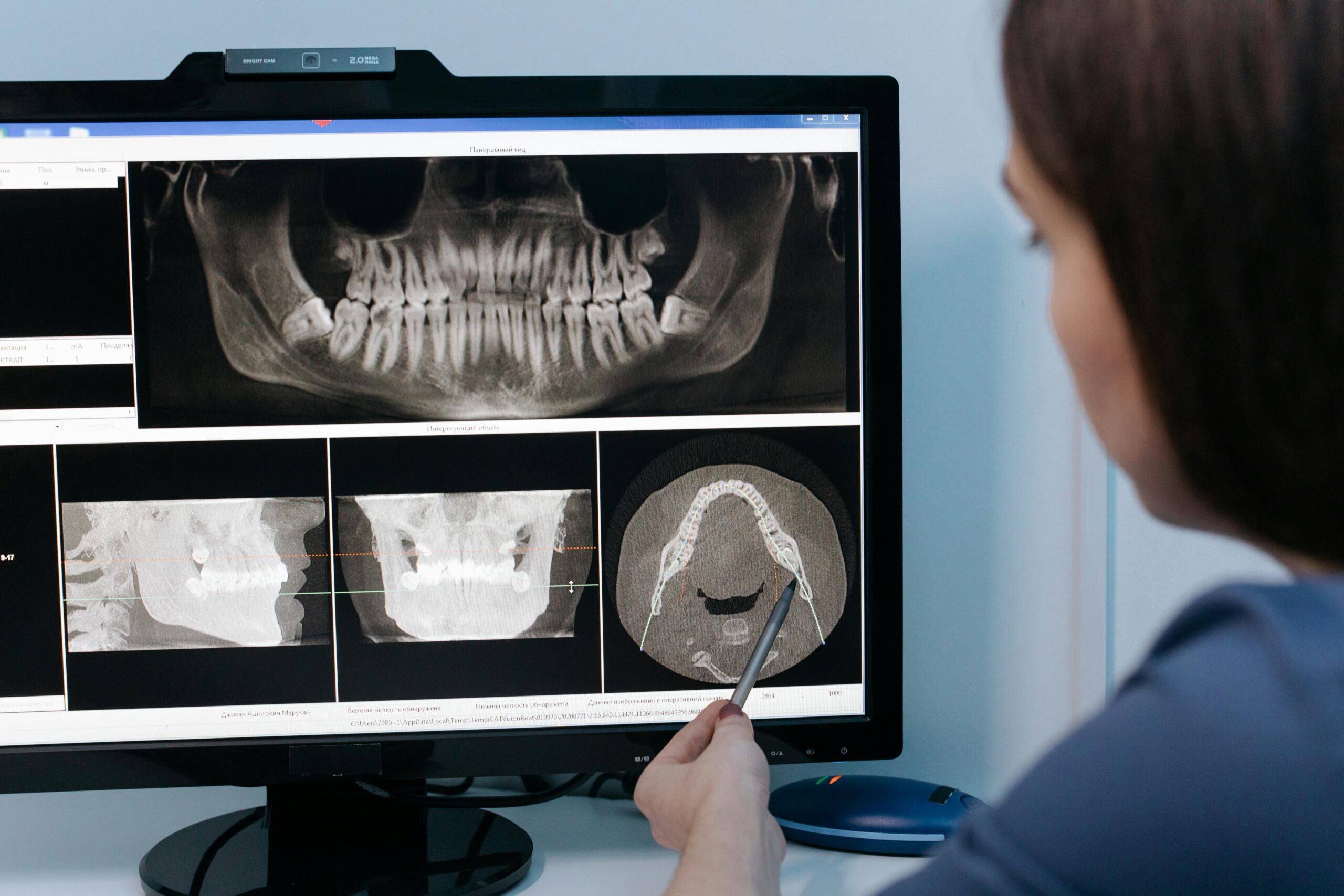 Inteligencia artificial odontologia