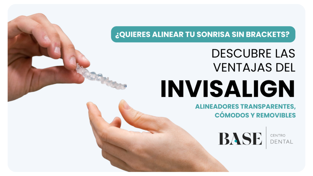 invisalign