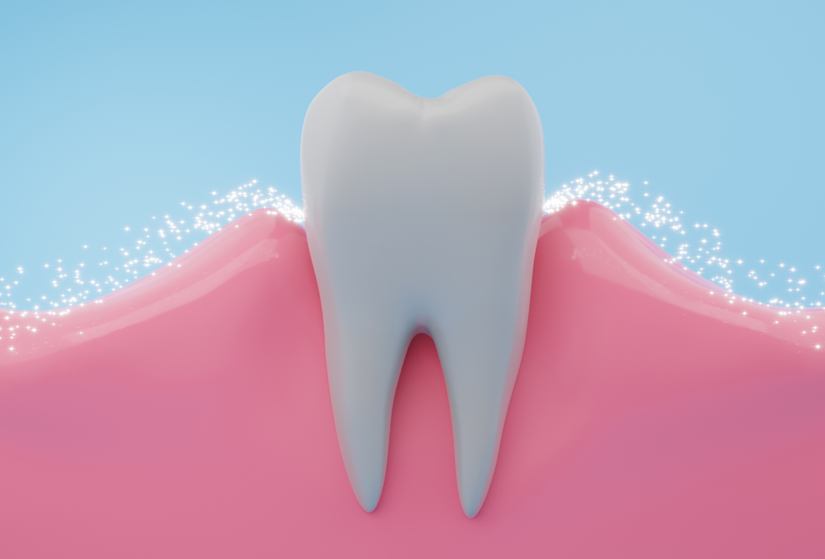 Cambiar todos los dientes: procedimientos y consideraciones