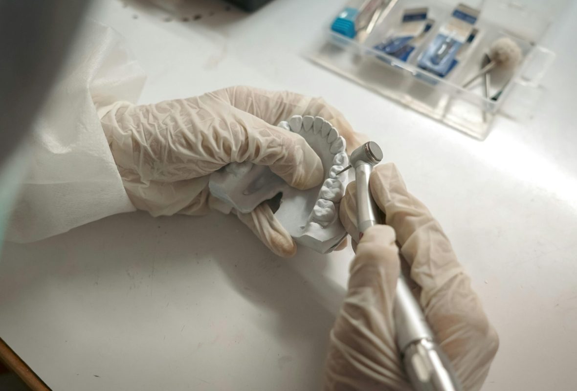 implante dental